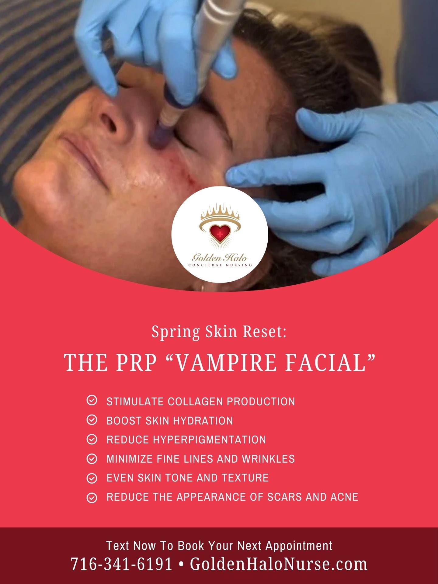 You are currently viewing Time for a Spring Skin Reset with our Vampire Facial!