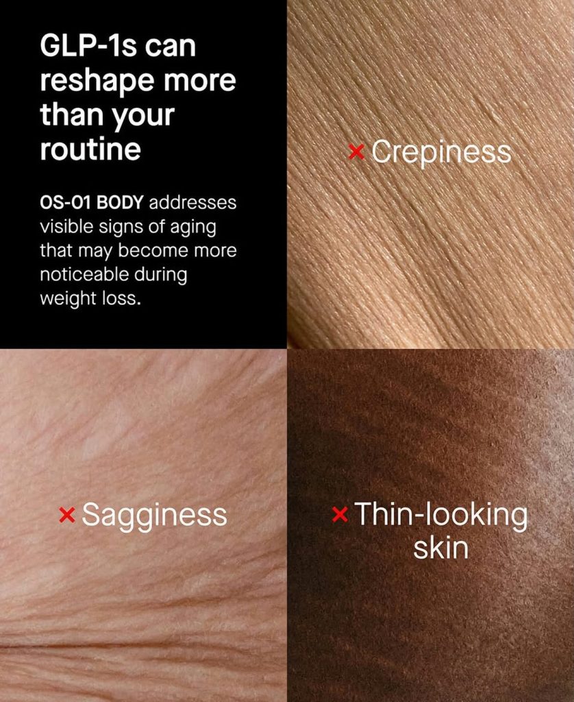 Don't worry, if you're a victim of glp1 consumption and now you are left with sagging skin and a "hollow" look…we have peptides for this!