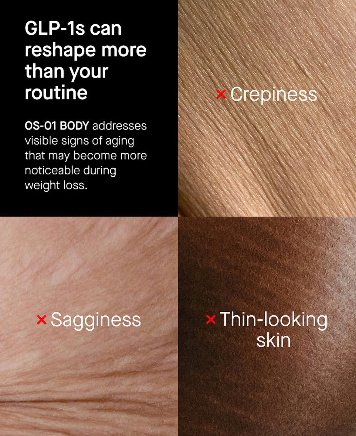 You are currently viewing Don’t worry, if you’re a victim of glp1 consumption and now you are left with sagging skin and a “hollow” look…we have peptides for this!
